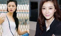 圈内爆料明星整容,明星整容真相大曝光！